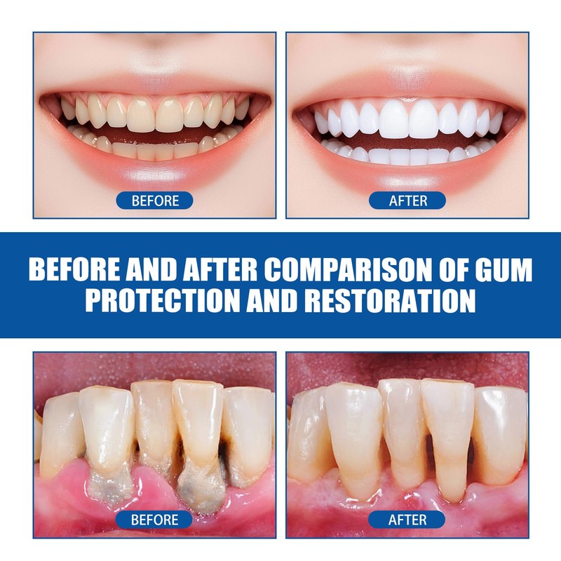 3 PCS Teeth Repair Gel, Gum Protect Repair Gel, Gentle