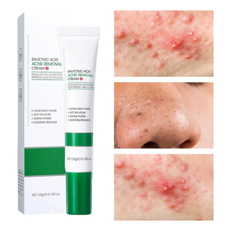 Crema Limpieza Facial Ácido Salicílico