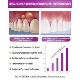 CAREDO Gum Toothpaste for Periodontitis, Gum Repair for Receding Gums, Gum Disease & Gingivitis Treatment, Periodontal Disease Treatment for Gum Health, Gum Disease Repair Bad Breath Toothpaste 3.52OZ