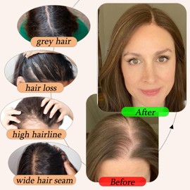 RICH BRIA Human Hair Toppers for Women with Thinning Hair Real Human Hair Topper Crown Topper No Bangs Clip in Hair Toppers for Hair Loss Grey Hair 10 Inch #4 Medium Brown