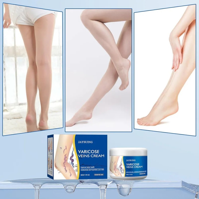 Crema De Varices Para Piernas, Cuidado Hidratante De La Piel