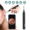 Z10 WiFi Ear Cleaning Endoscope High Definition Wireless Ear Camera
