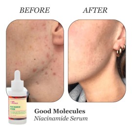 Good Molecules Sérum Niacinamida 30ml Antiarrugas Piel Mixta/Grasa