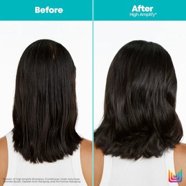 Matrix High Amplify Complete Quad Bundle