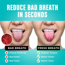 Mouthology Tongue Scraper (2 Pack), Reduce Bad Breath (Travel Cases Included), Stainless Steel Tongue Cleaners, Metal Tongue Scraper, Tongue Scraper for Adults - Fresher Breath in Seconds