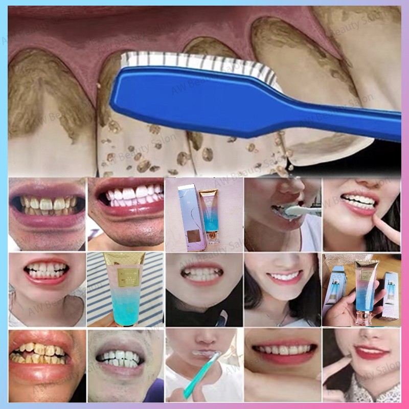 Nicotinamide Teeth Whitening toothpaste Remove Tartar Pemutih gigi kuning pembersih
