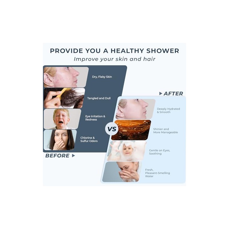 Ryamen 2026 Magnetic Filtered Shower Head with Handheld– High Pressure