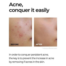 SOME BY MI Miracle AC Clear Spot Treatment 10g