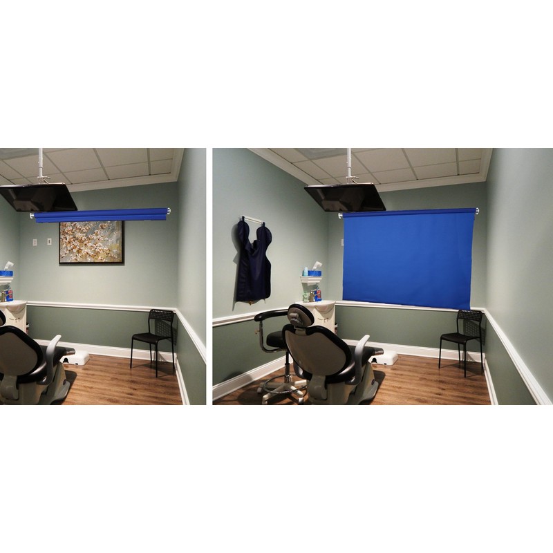 White Large Spring-Powered Roll-Up/Pull-Down Background Before & After