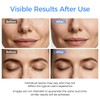 Skin Scrubber Face Spatula, Blackhead Remover Tool for Facial Deep