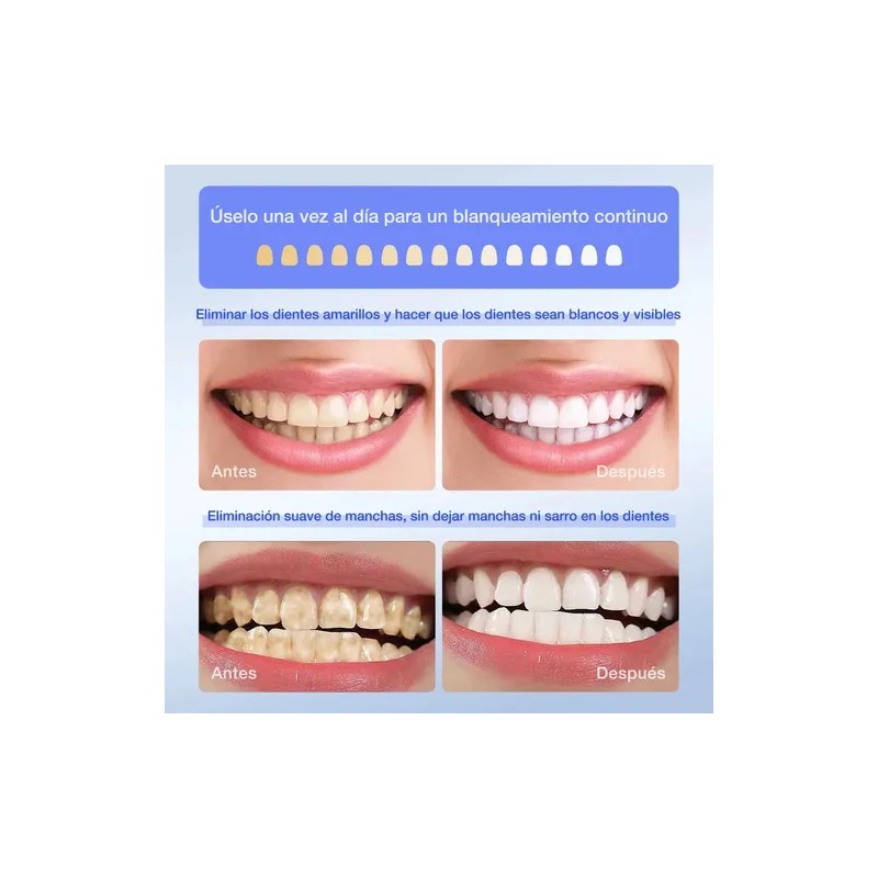 Tiras Blanqueadoras Dentales Airuidu 5d White 28 Piezas 14 Pares