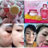 KONE FACIAL CREAM Skincare set-100% original