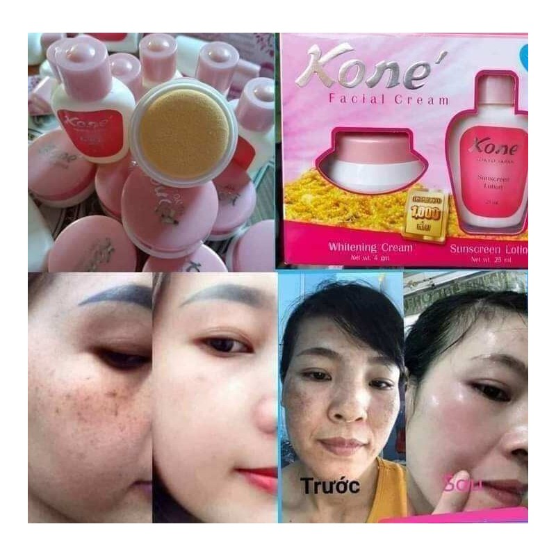 KONE FACIAL CREAM Skincare set-100% original