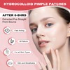 Pimple Patches for Face, Hydrocolloid Acne Patches Zit Patches for