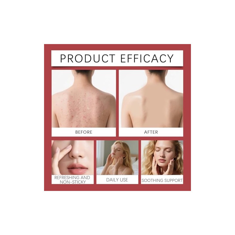 Strawberry Skin Cream with Triple Acid for Daily Body Exfoliation