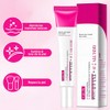 Txa Cream Crema Manchas Faciales Arbutin Aclaramiento Piel Oscuras Pecas