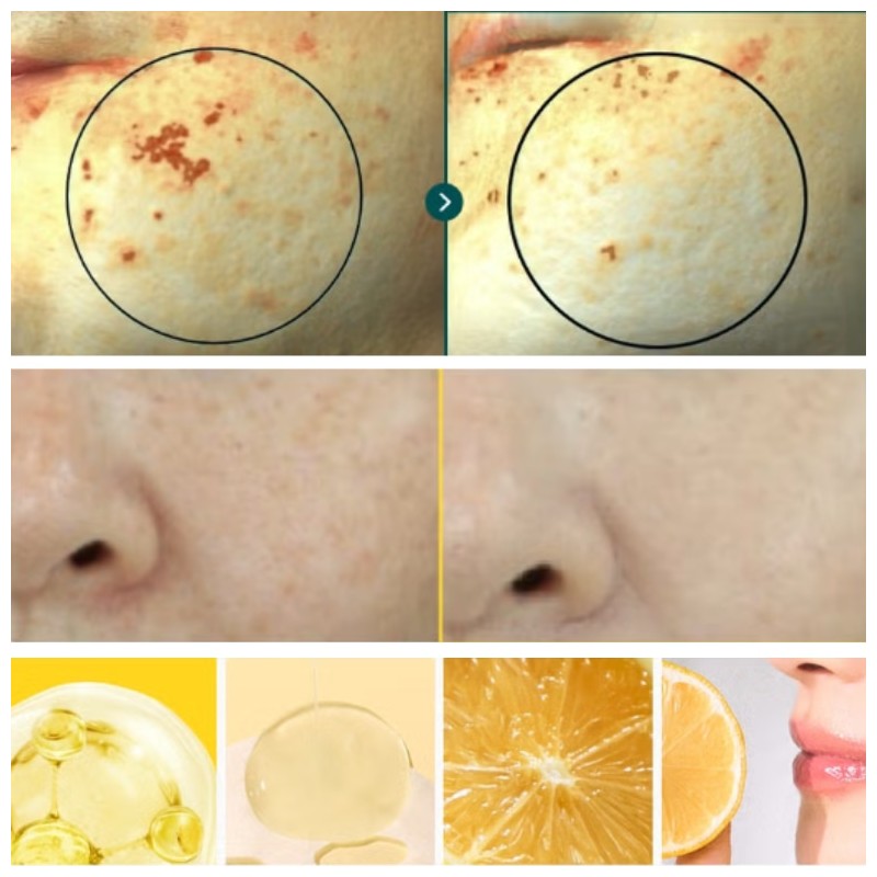 BONCEPT Vita C Ampoule Eye Gel Patch 18g 12ea