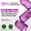 JUMISO Niacinamide 10 Serum - Korean Face Serum with Glutathione,