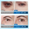 GNHG Eye Pads, Eye Pads Against Dark Circles, Remove Dark