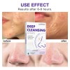 Tiras Nasales Limpiadoras For Eliminar Puntos Negros, &ac
