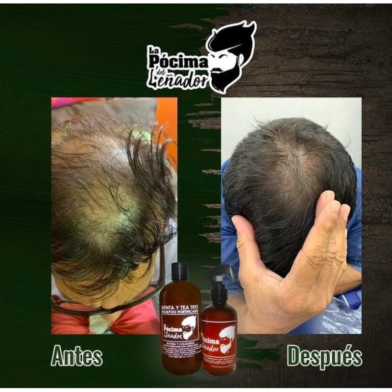 Kit Shampoo De La Pócima Del Leñador