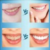 Best Versión Mejorada 3d Blanqueamiento Dental Pegatinas 14 Pares