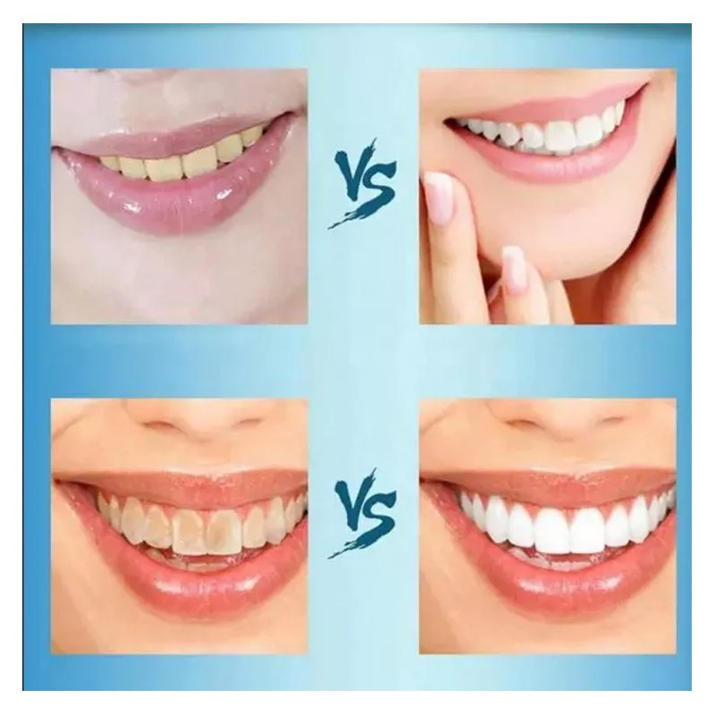 Best Versión Mejorada 3d Blanqueamiento Dental Pegatinas 14 Pares