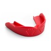 3D Mouthguard