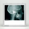 Med&Led Negatoscopio Dental Led 30x30 Lateral De Craneo, Panoramica