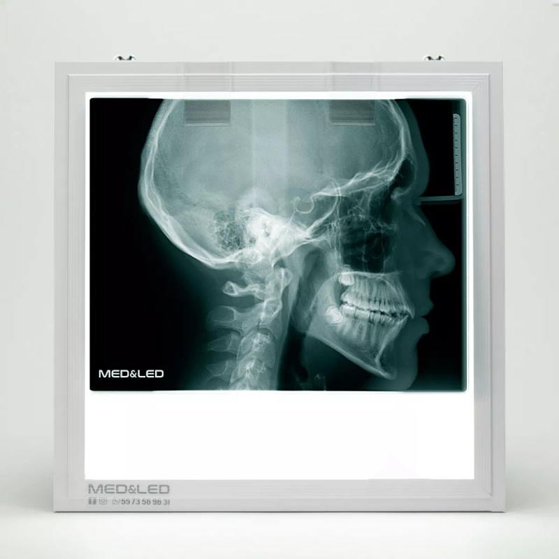 Med&Led Negatoscopio Dental Led 30x30 Lateral De Craneo, Panoramica