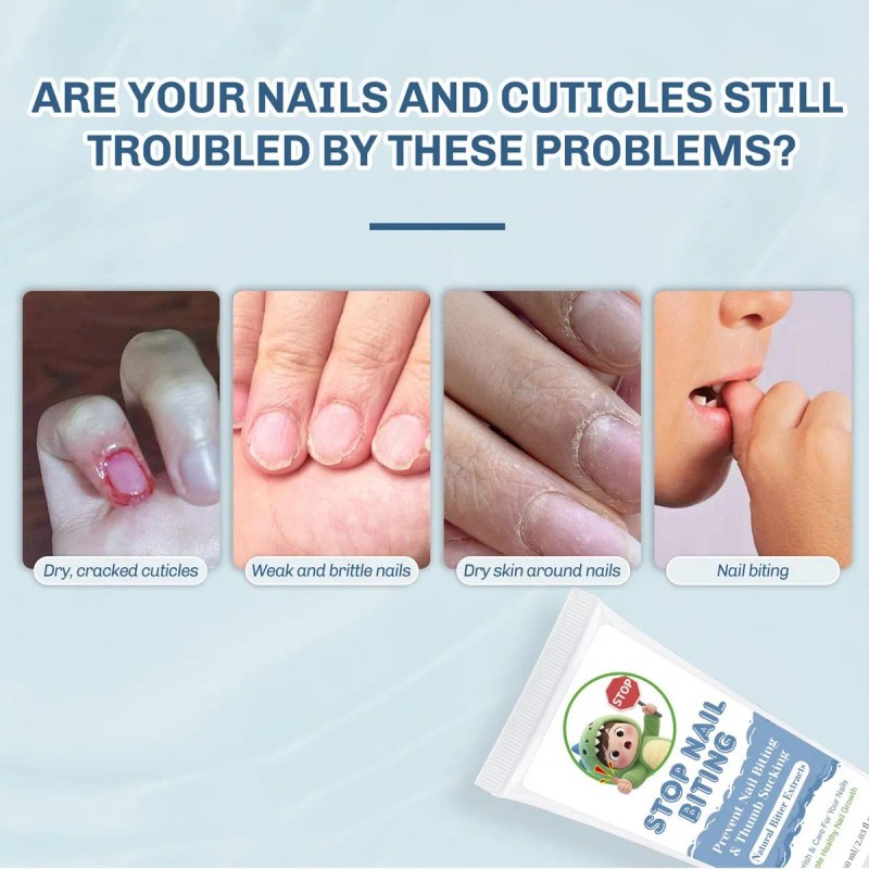 Crema Para El Cuidado De Uñas: Morder Las Uñas, Comer