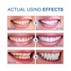Sp-6 Toothpaste, 120 G Probiotics Bright White Toothpaste Toothpaste Sp-6