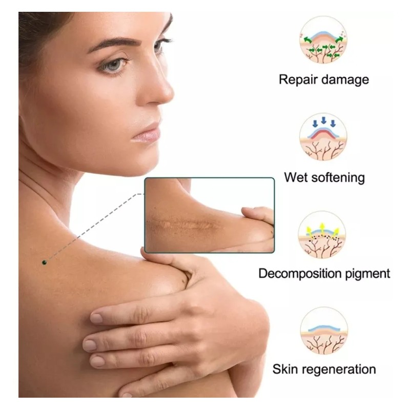 Parche P/cicatriz Abdominoplastia (3m / Original) Neutra