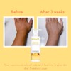 WishCare Sunscreen Body Lotion with SPF 50 PA+++ - Broad