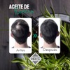 Khaliss Aceite de Romero 100 Puro Crecimiento Capilar, Fortalecimiento y