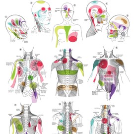 Anatomy Lab Trigger Points I Poster, LAMINATED, Anatomy and Physiology Trigger Points Poster, 17.3 x 22.5 Inches, Trigger Points Anatomy Poster