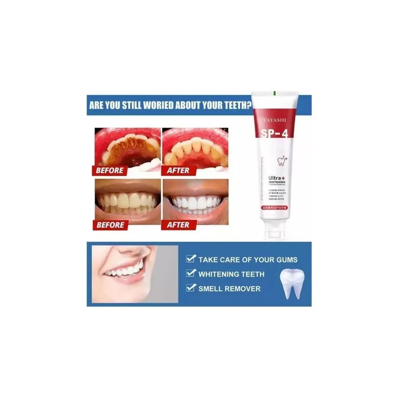 Pasta De Dientes Sp-4 Con Probióticos Blanqueadores