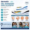 Parches Cuidado Facial Elimina Acné Espinillas Figuras 1016p