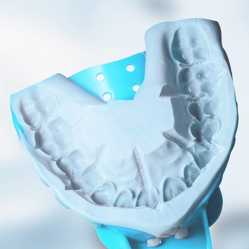 JMU Dental Impression Tray, Perforated Disposable Trays, 8 Quadrant UR/LL,