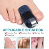 Welnove 1 Pair Toe Splint,Toe Straightener for Hammer Toe,Bent Toe,Claw