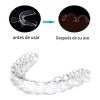 Veraly Protectores Bucales, Guardas Dentales De Gel Moldeables 2pz Color