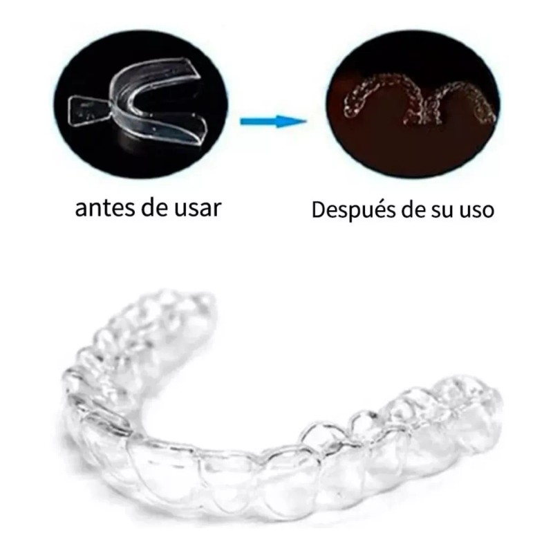 Veraly Protectores Bucales, Guardas Dentales De Gel Moldeables 2pz Color
