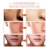 Esencia Facial 5 En 1 Antiarrugas, Reafirmante Y Que Decolor