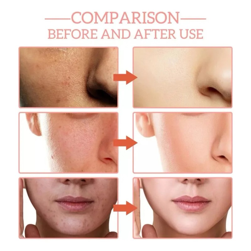 Esencia Facial 5 En 1 Antiarrugas, Reafirmante Y Que Decolor