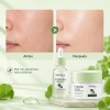Kit Facial Centella Asiática Suaviza Regenera Hidrata 6 Pza