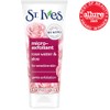 St Ives Exfoliante facial suave y suavizante, 170 g