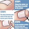 Ingrown Toenail Correction Set of 50 Toenails Toenail Correction for