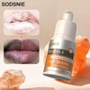 Mascarilla de Burbujas para Labios - Fórmula Aclarante y Exfoliante