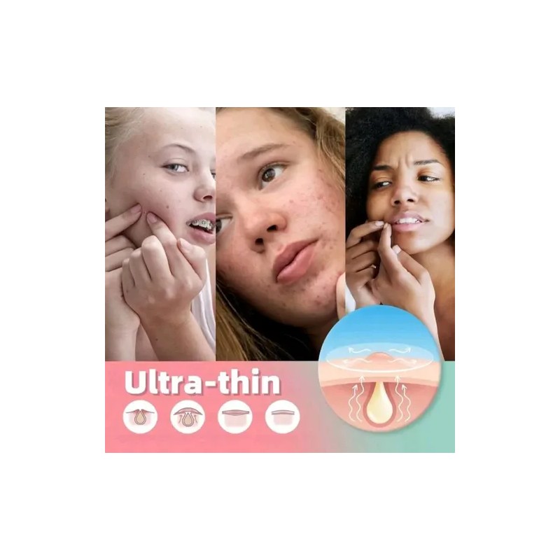 Pimple Patch 432 Parches Para Acne Cuidado Facial Skinecare