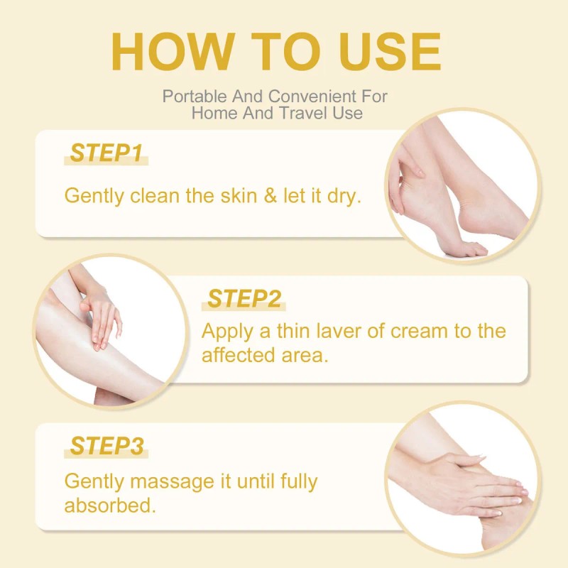Sequedad, Agrietamiento Y Descamación De Los Pies Con Crema